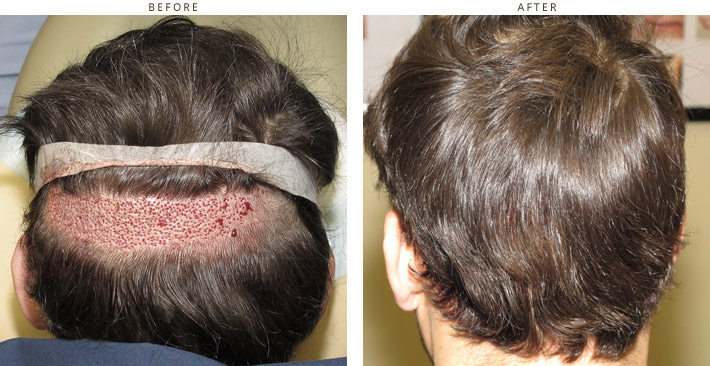 scalp exercises to regrow hair